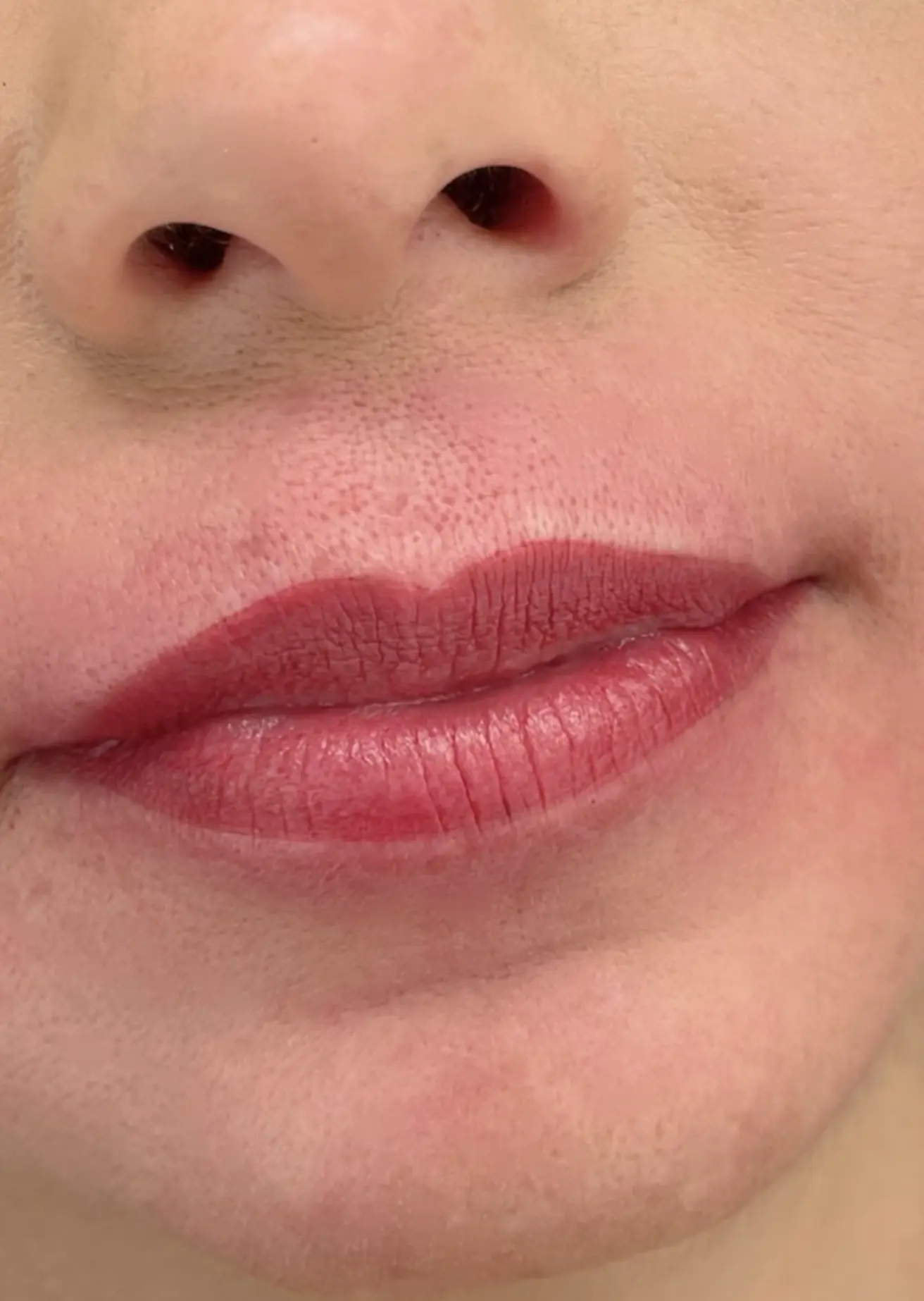 lip tattoo swelling and peeling